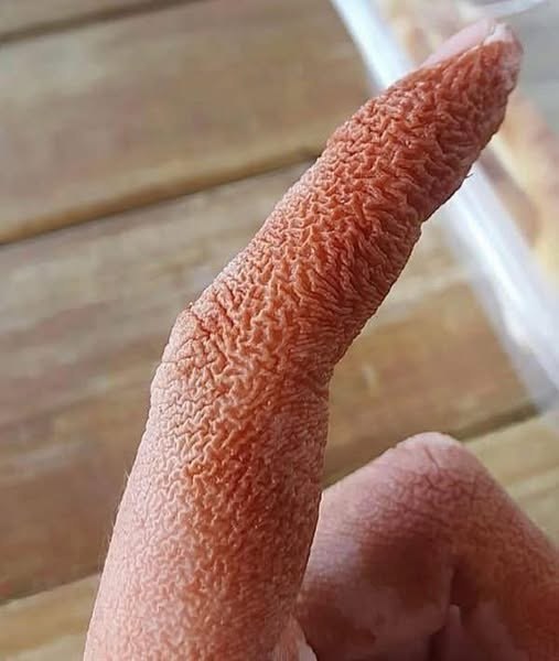 Understanding What Your Feet May Be Telling You: Common Causes of Swelling and When to Seek Care