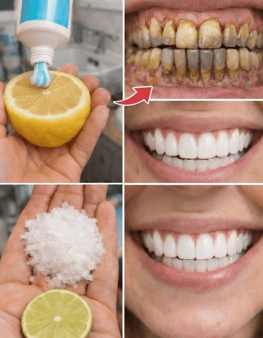 A Thoughtful and Gentle Guide to Brightening Your Smile at Home Using Simple Kitchen Ingredients