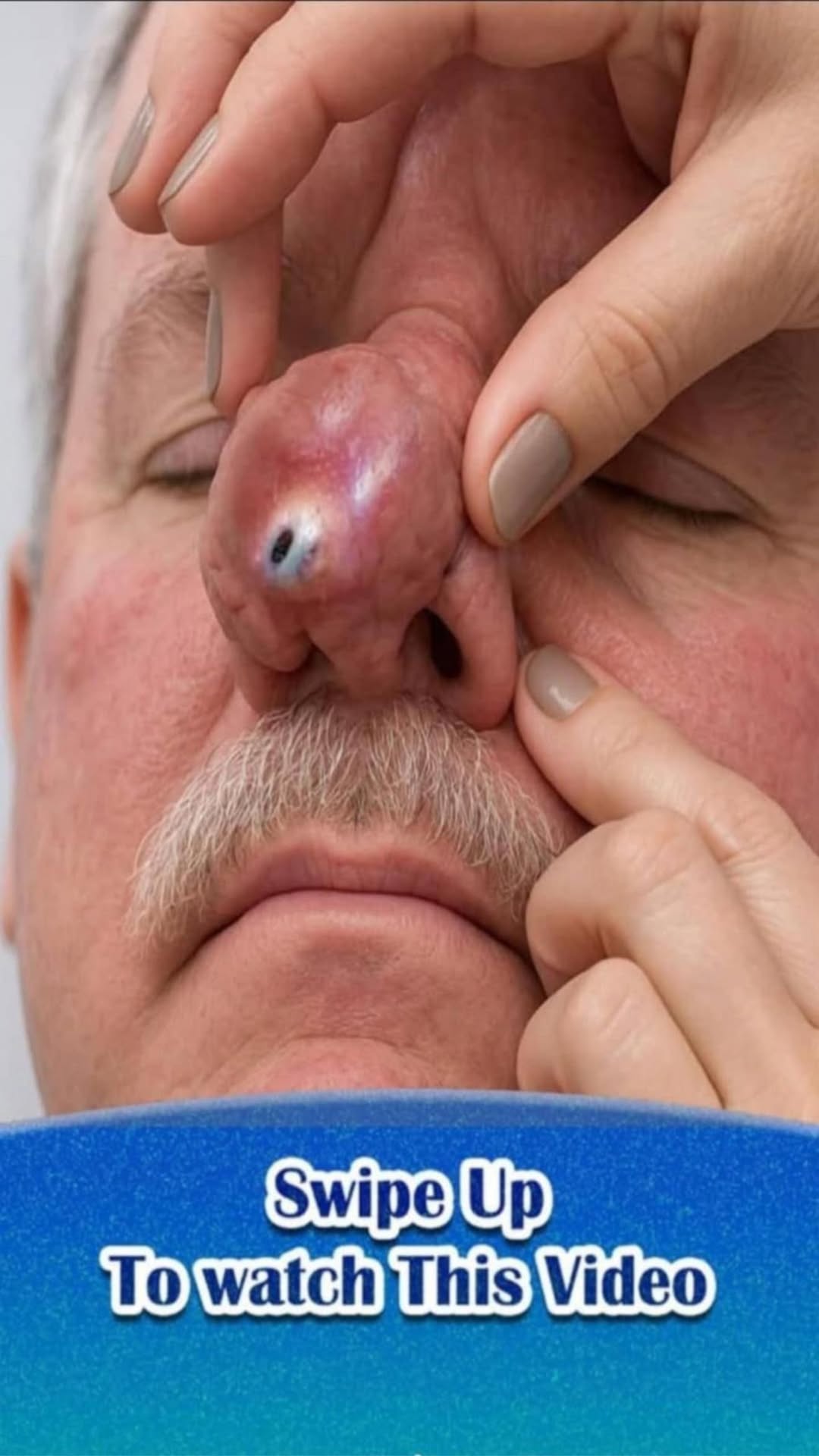 When to See a Dermatologist for Acne: Signs You Shouldn’t Ignore