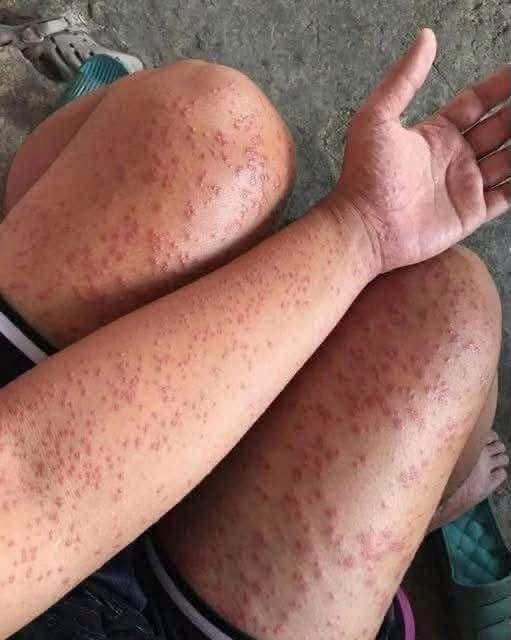Alert: These Are the Warning Signs of Dangerous Creosote Buildup in Your Home